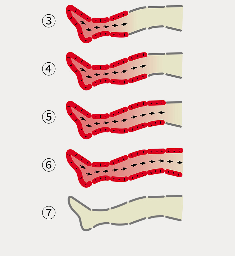 Heating+Compression therapy
