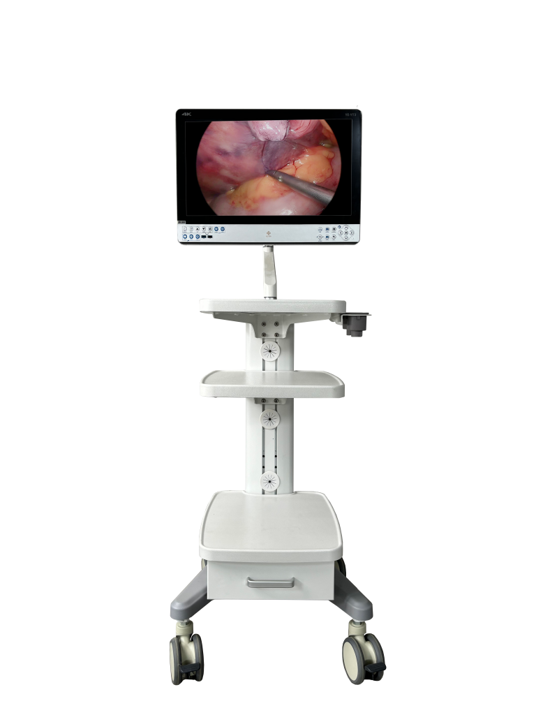 4K Medical Integrated Endoscopic Camera System: Revolutionizing Medical ...